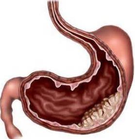 胃炎可以吃角瓜,天然食疗新选择